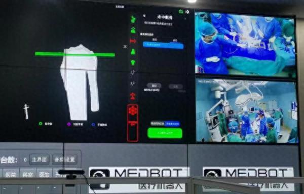 九院骨科团队顺利完成首例国产骨科手术机器人5G远程膝关节置换手术